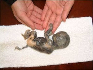 Aborted-fetus1-300x225.jpg